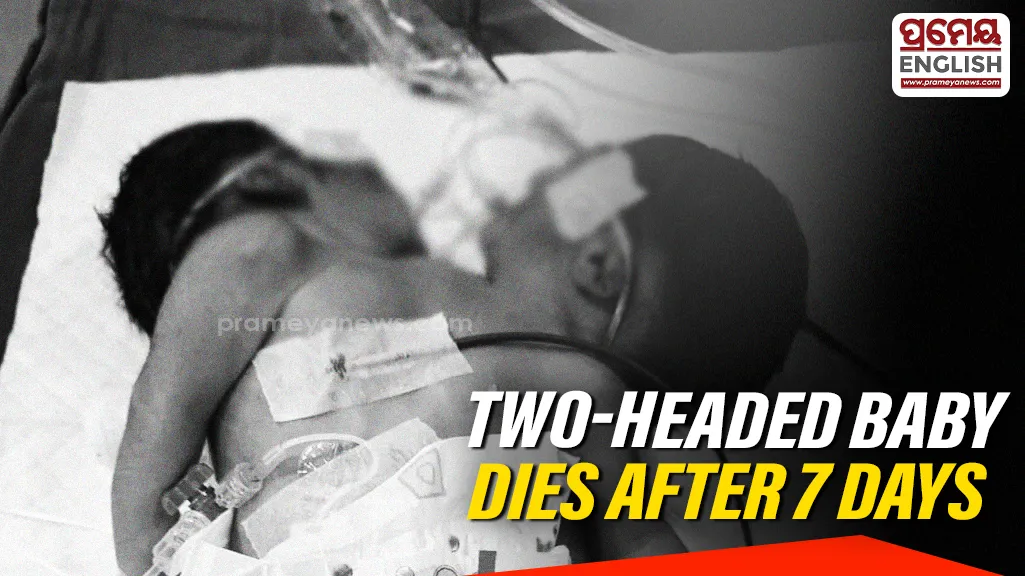Newborn baby with two heads dies after seven days of treatment At MKCG hospital
