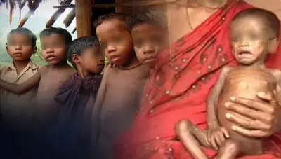 Jajpur’s forgotten children continue to battle malnutrition