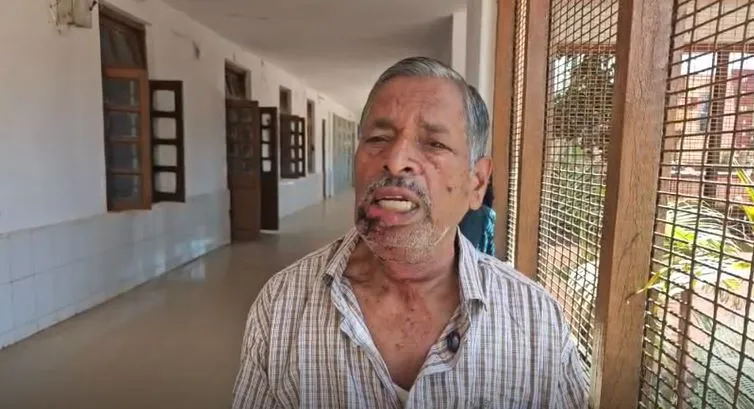Stray dog attacks 79-year-old retired teacher during evening walk in Odisha