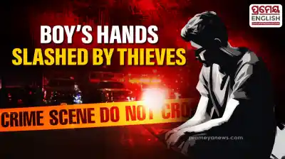 Minor Boy's hands slashed by robbers in Mayurbhanj after failed theft attempt
