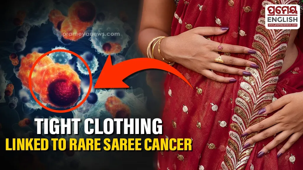 Why Your Saree Petticoat Might Be Damaging Your Skin and Leading to Serious Illness