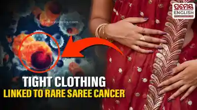 Why Your Saree Petticoat Might Be Damaging Your Skin and Leading to Serious Illness