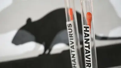 Evacuated Cruise Passenger Tests Positive for Hantavirus during their Flight Home