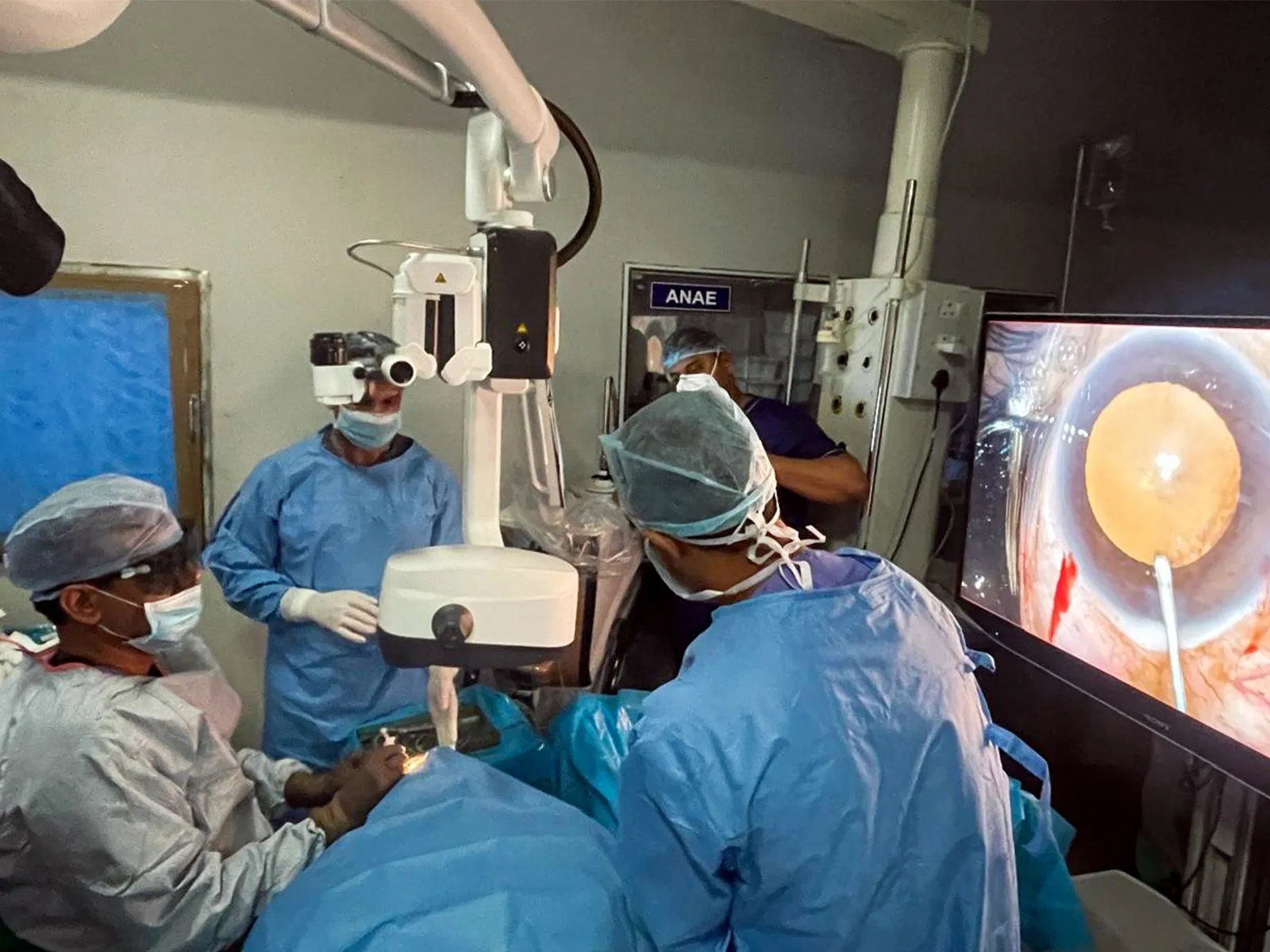 India's rising heatwave triggers surge in eye problems; ophthalmologists urge preventative care