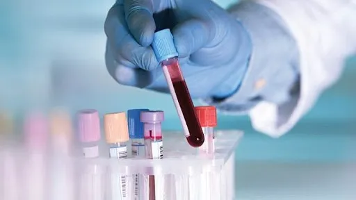 Centre simplifies drug import rules for examination, testing and analysis

