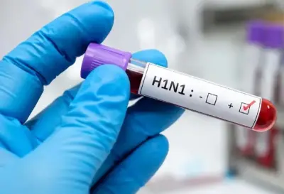 H1N1 Alert: Medical Experts Issue Urgent Warning over Self Medicating During Rising Flu Outbreaks