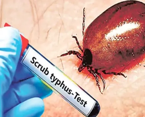 No need to panic over scrub typhus reports in Angul: Health Department