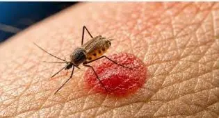 Chandipura virus outbreak: National Joint Outbreak Response Team deployed