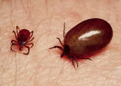 Scrub Typhus cases cross 800 in Sundargarh, health department steps up surveillance