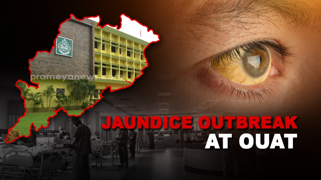 Jaundice Outbreak Hits Odisha   OUAT Hostels, Students Infected