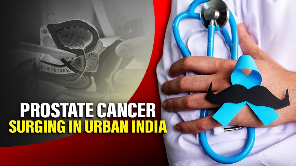 Prostate Cancer Rising in Urban India: Lifestyle & Diet Key Causes