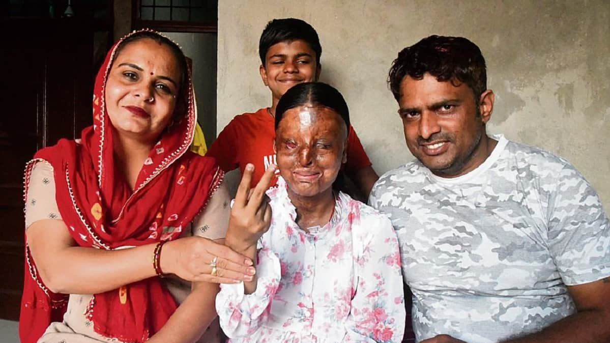 Kafi Acid Attack Survivor | Class 12 Topper with IAS Dream