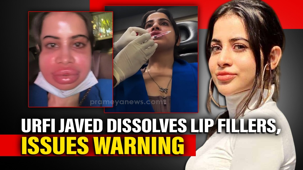 Urgent! Urfi Javed’s Lip Filler Warning | Cosmetic Safety