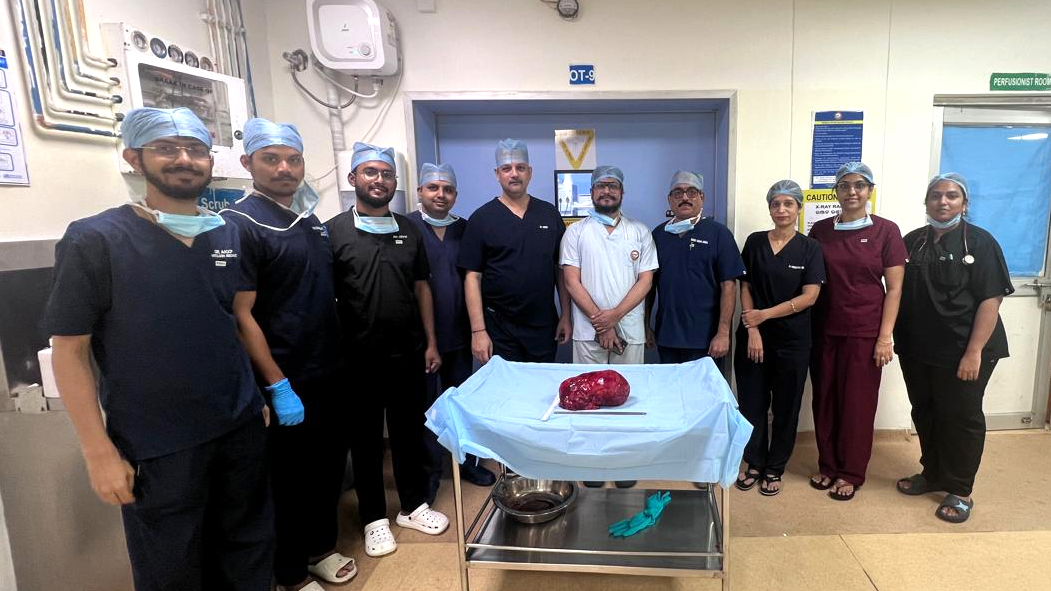 Largest kidney tumour in Odisha removed by SUM doctors