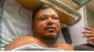 The door broke open, found a slit to escape from wreckage: Says lone survivor of Ahmedabad Plane Crash 